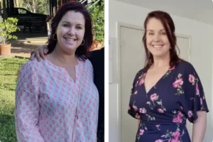 A Lady before and after Juniper weight loss