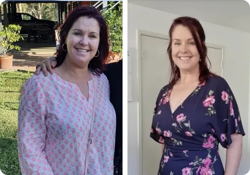 A Lady before and after Juniper weight loss